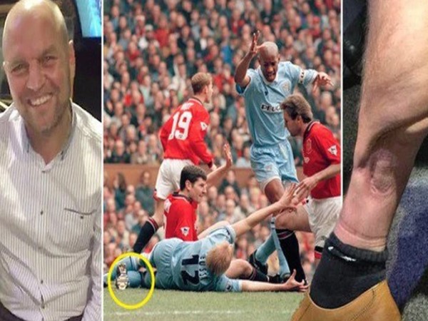 David Busst – Chấn thương tồi tệ nhất lịch sử Premier League (1996)